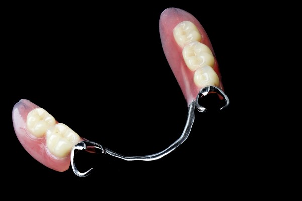Tooth Replacement With Partial Dentures